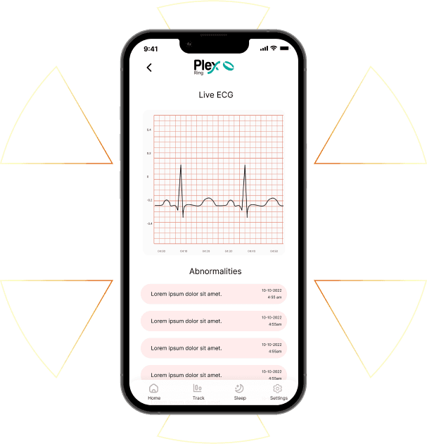 Plex Ring app image showing live ecg with Sparkleo background